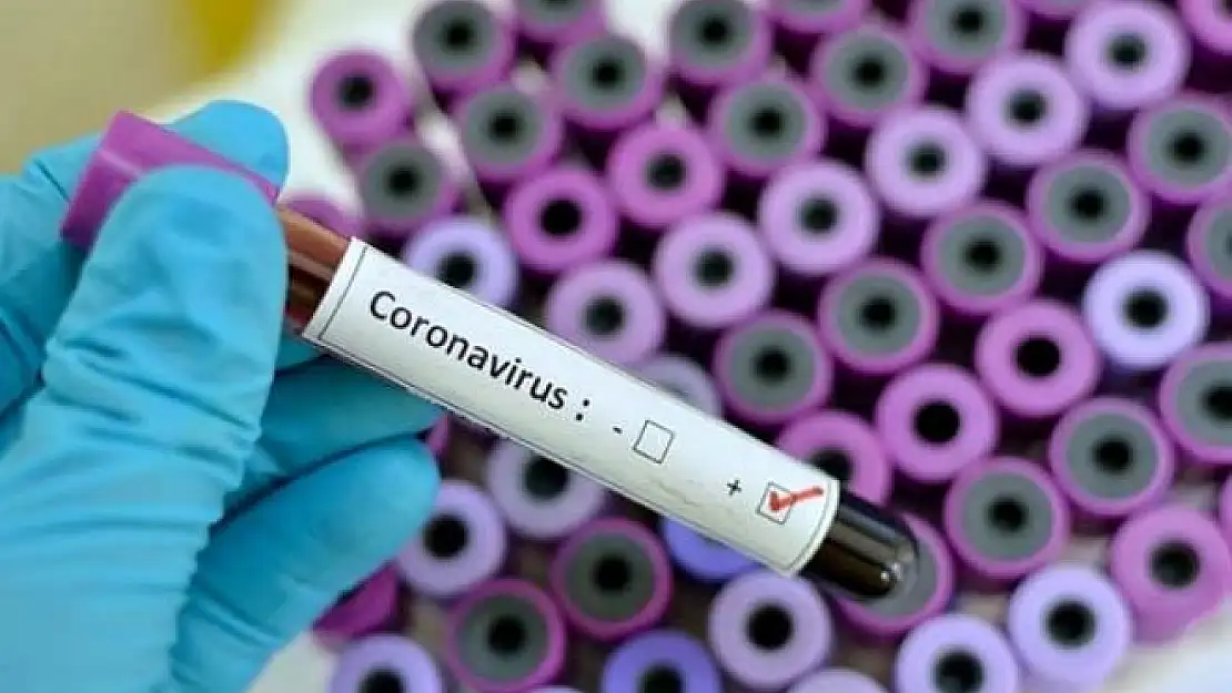 Vatandaşlara Çok Önemli Kurban Bayramı Uyarısı Yapıldı: 1 Milyon Kişi Risk Altında
