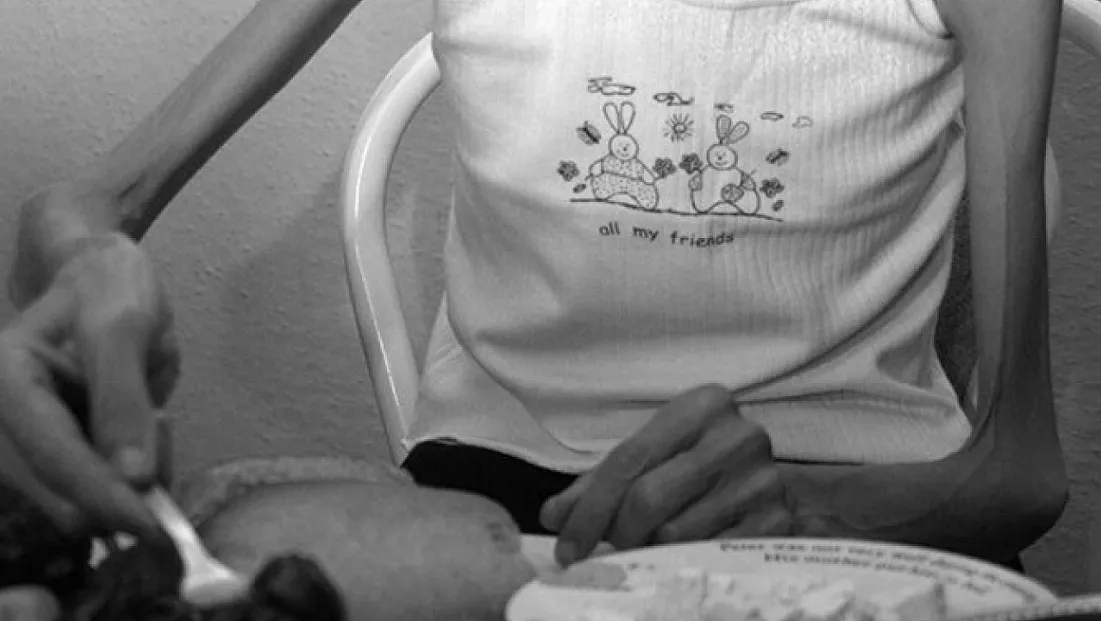 Anoreksiya Sessizce İlerliyor, Ölümle Sonuçlanabiliyor: Ailelere Uzmandan Hayati Uyarı