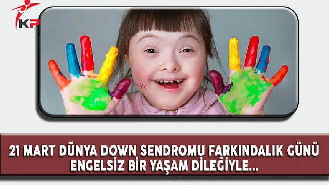 21 Mart Dünya Down Sendromu Günü