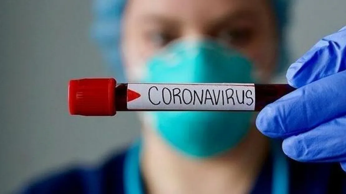5 Eylül corona virüsü tablosu açıklandı!