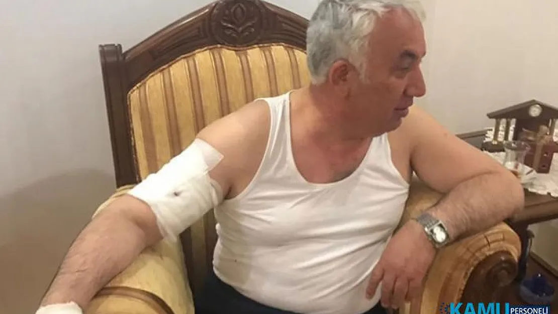 Belediye başkanı köpek saldırısına uğradı