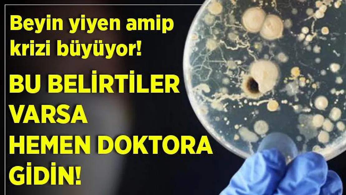 Beyin yiyen amip krizi büyüyor! Bu belirtiler varsa hemen hastaneye gidin!