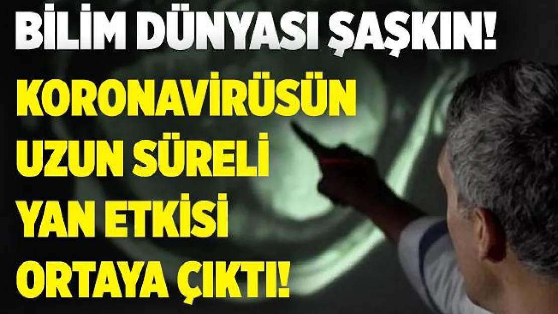 Bilim adamlarından şoke eden açıklama! Koronavirüsün uzun süren yan etkisi ortaya çıktı! Kolay kolay geçmiyor!