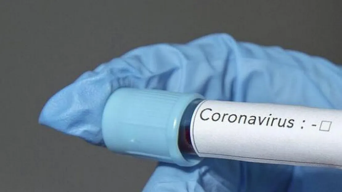 Corona Virüsü İnsan Üretimi Mi? İstihbarat Direktörlüğü Açıkladı