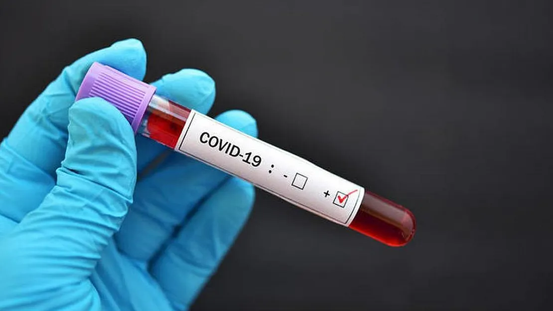 Covid-19 Aşı Takip Haritası Kullanıma Açıldı! İllere Göre Aşı Oranları
