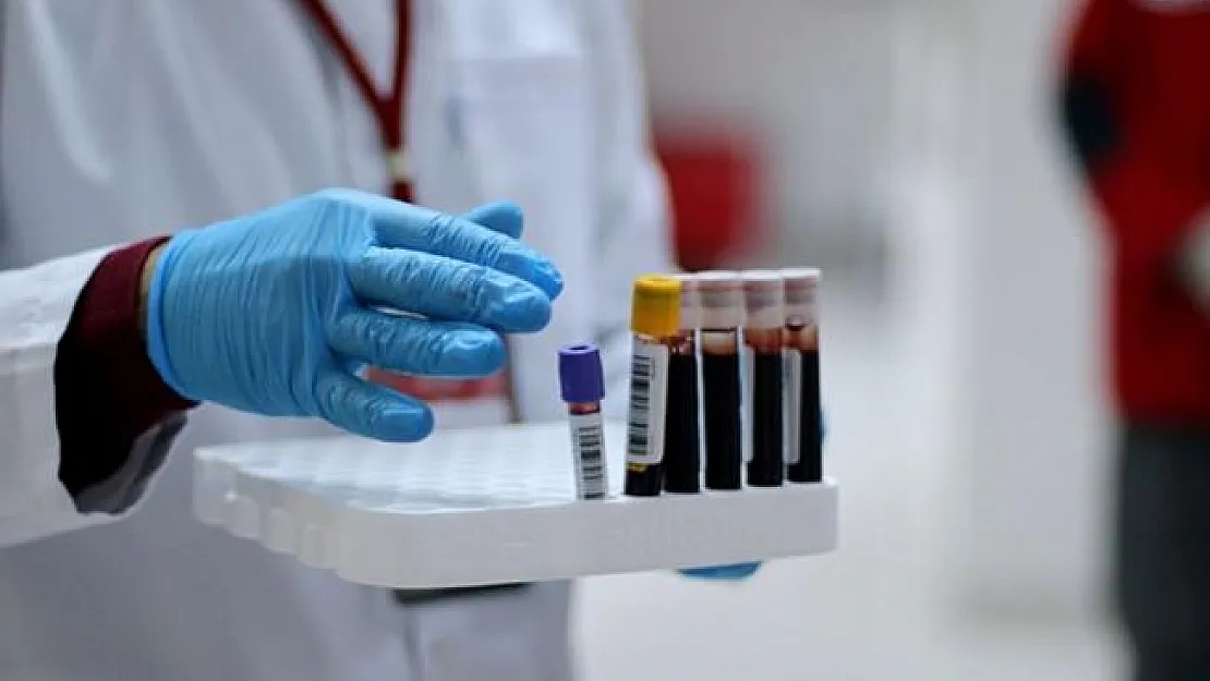 Covid-19 Hastasına Plazma Nakli Yapıldı: Yeni Test Sonucu Negatif Çıktı