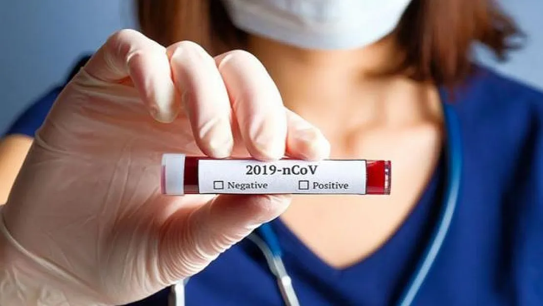 Covid-19 için yeni plan! O ilde rastgele test uygulamasına geçiliyor