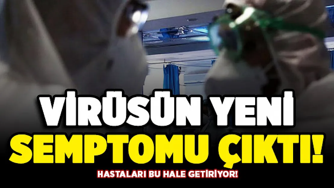 Covid-19'un bir semptomu daha ortaya çıktı! Hastaları bu hale getiriyor