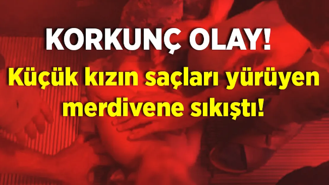 Dehşet verici olay! Küçük çocuğun saçları yürüyen merdivene sıkıştı!