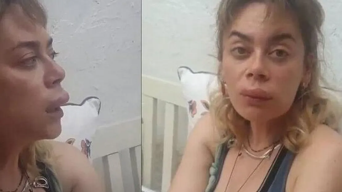 Demet Evgar'ın başına gelmeyen kalmadı! Önce arı soktu sonra..