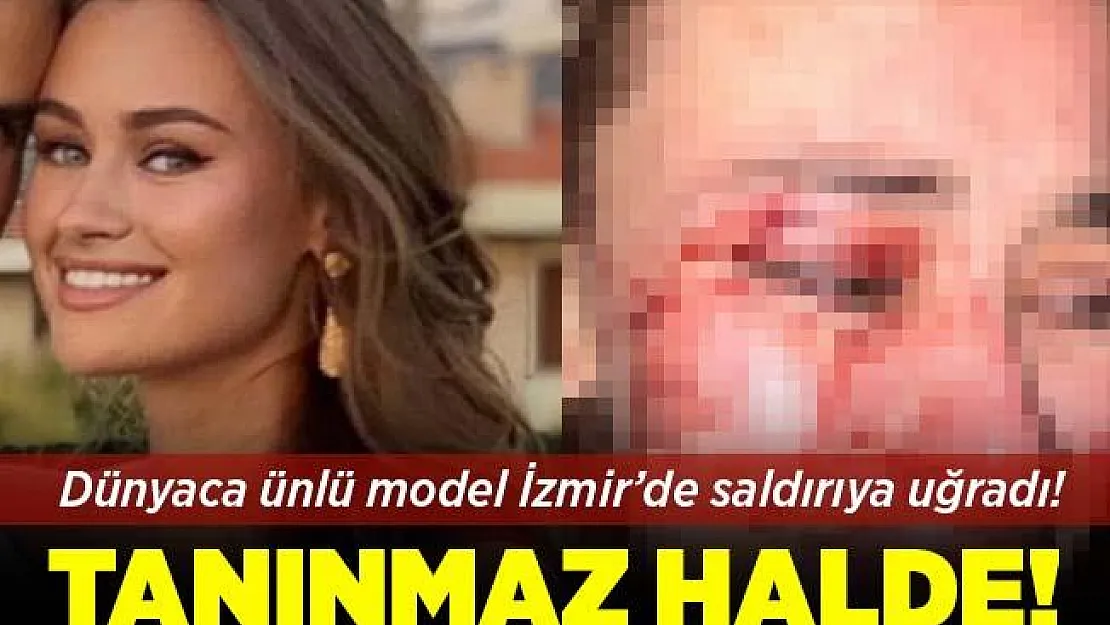 Dünyaca ünlü model Çeşme'de güvenlik görevlilerinin saldırısına uğradı! Tanınmaz hale geldi!