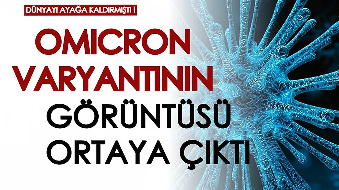 Dünyayı alarma geçiren varyantın görüntüsü çekildi! Dünya Sağlık Örgütü'nden yeni 'Omicron' açıklaması geldi