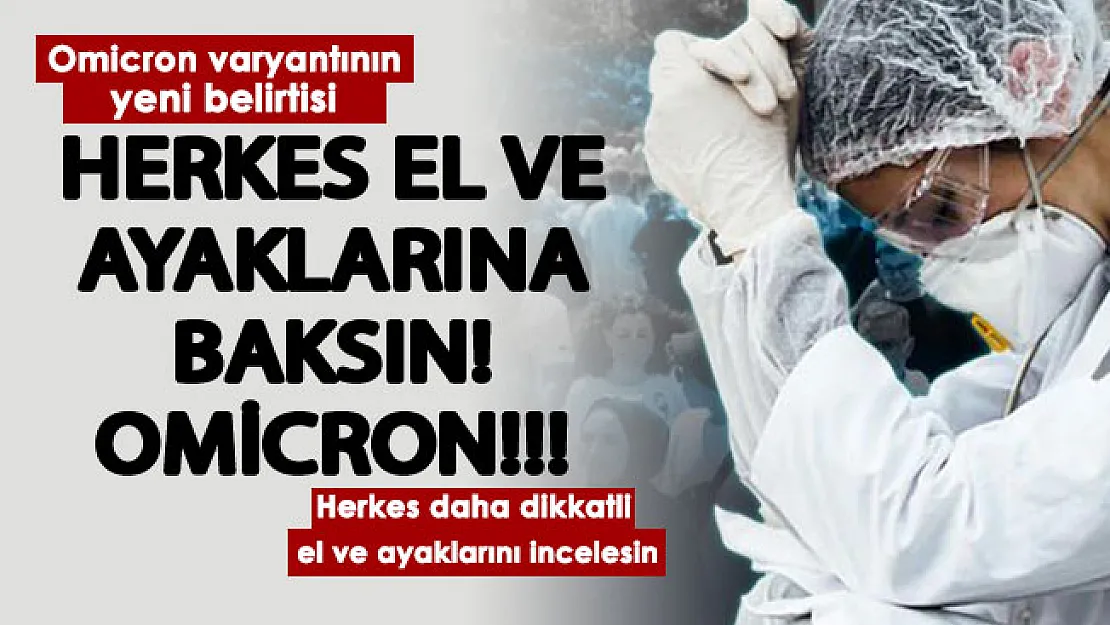 El ve ayaklarınıza bu kez daha dikkatli bakın! Ülkemizdeki Omicron'un yeni belirtisi açıklandı