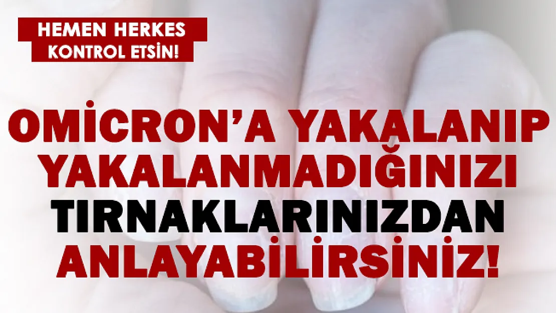 Herkes tırnaklarını kontrol etsin! Yeni Omicron'u tırnaklarınızdan tanıyabilirsiniz!