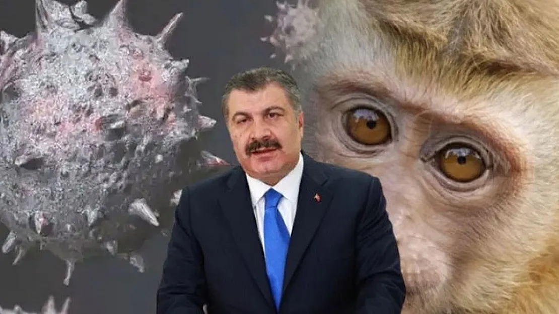 İlk Covid vakasını duyurmuştu! Maymun çiçeği virüsü ülkemizde yayılıyor mu? Bakan Koca resmen duyurdu