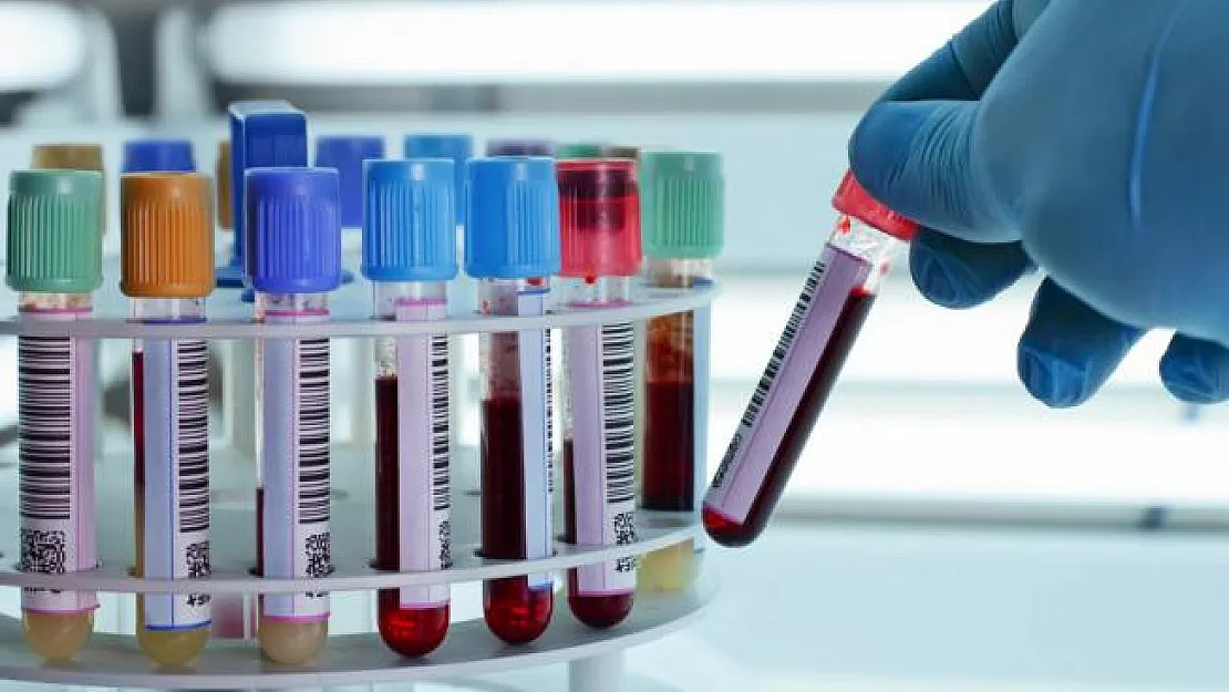 Kanser bu test ile erken teşhis edilebilecek!