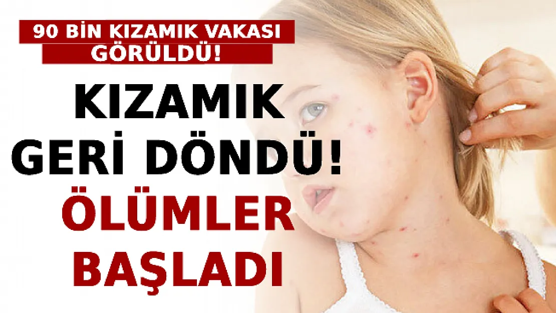 Kızamık Geri Döndü: Ölümler Başladı
