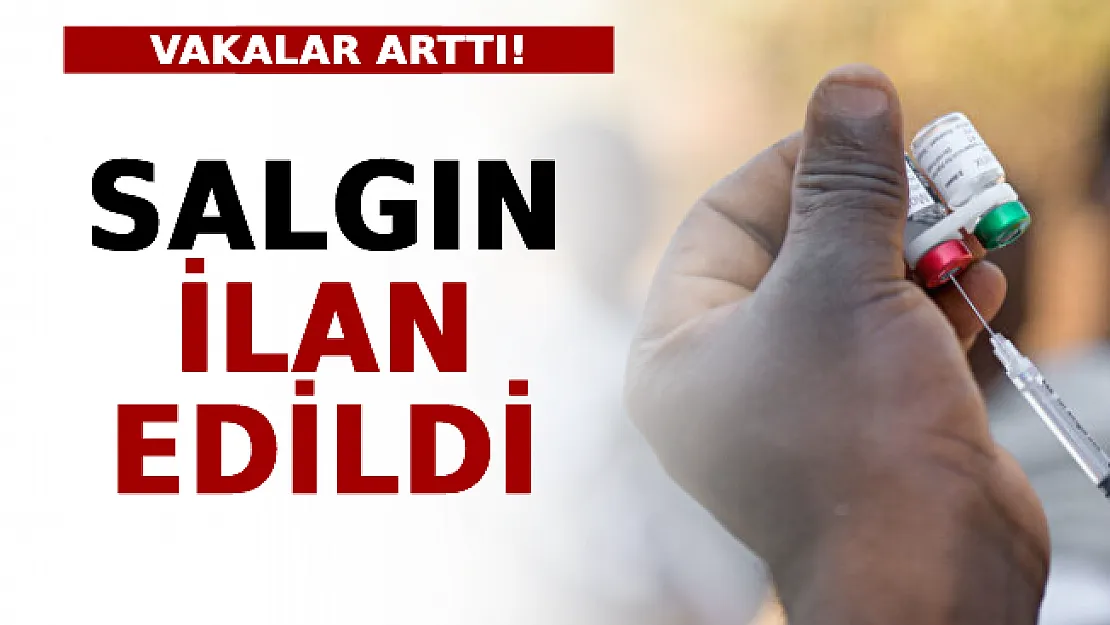 Kızamık Vakaları Arttı! Salgın İlan Edildi