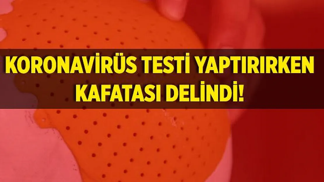 Korkunç olay! Koronavirüs testi yaptırırken kafatası delindi!