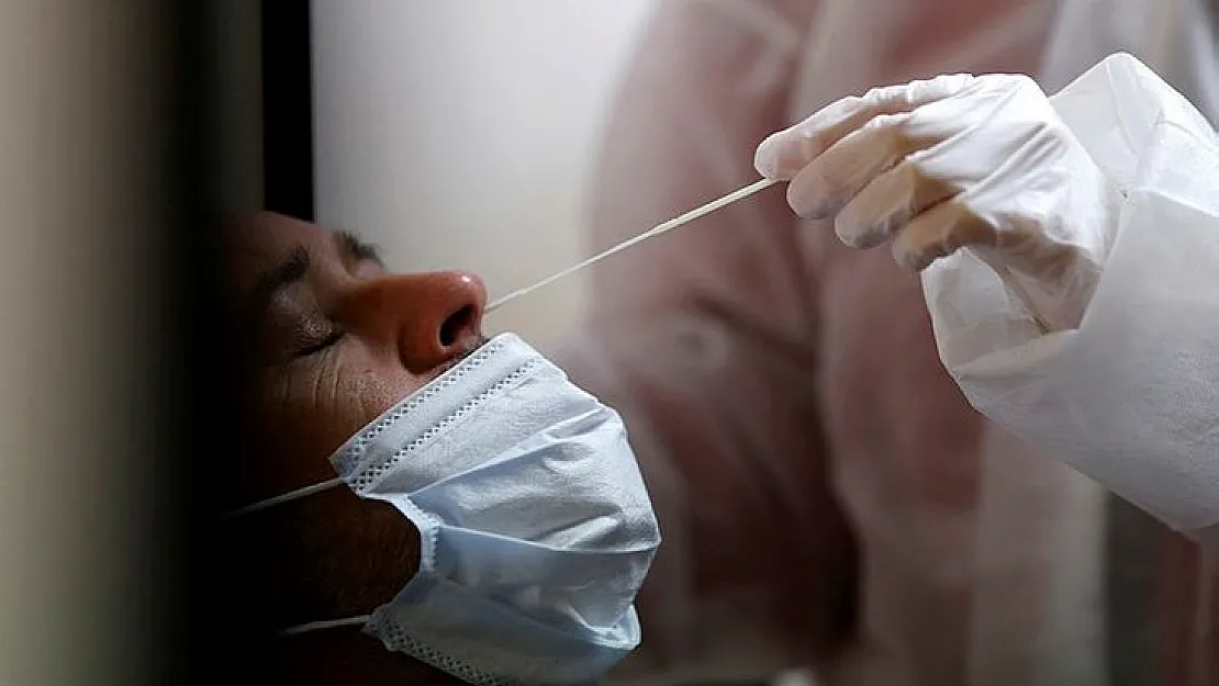 Korona testinde herkesin canı acıyordu: Kovid-19 testi için yeni dönem başlıyor! İşte yeni test yöntemi