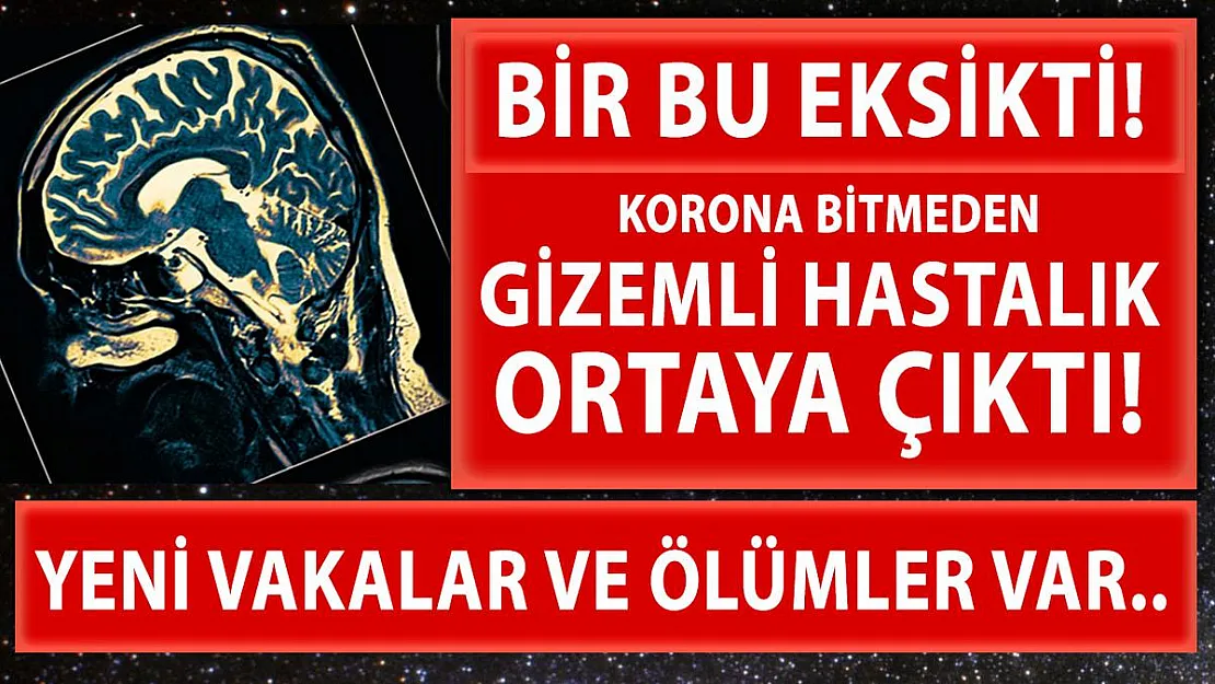 Koronavirüs bitmeden bir gizemli hastalık daha ortaya çıktı!