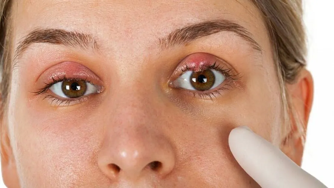 Koronavirüse ilişkin yeni uyarı geldi! Gözünüze dikkat!