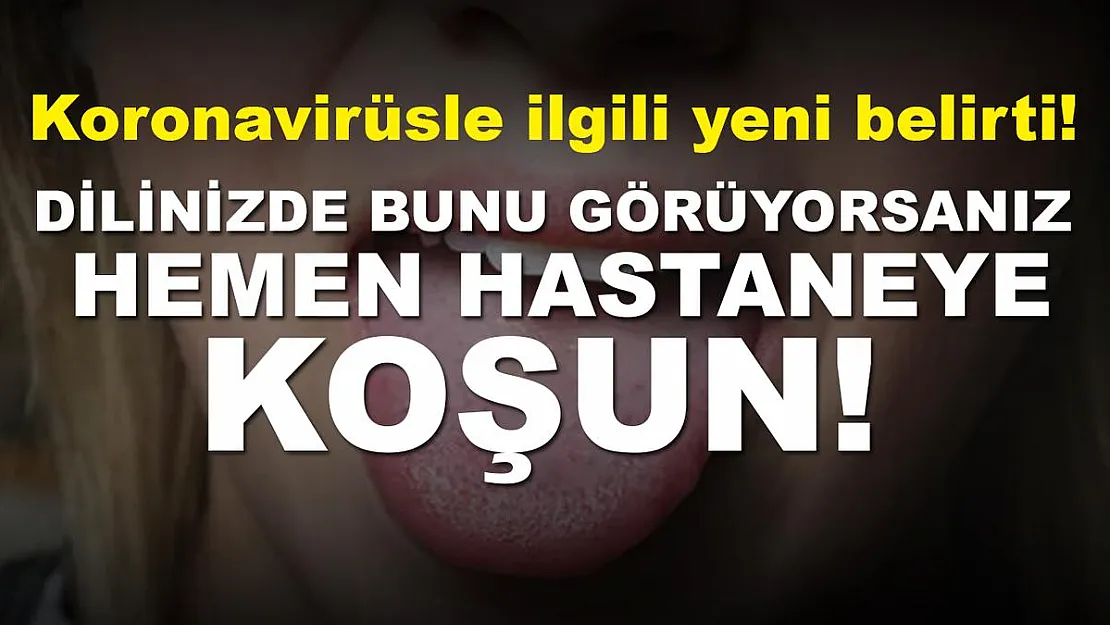 Koronavirüsle ilgili flaş uyarı yapıldı! Dilinizde bunu görüyorsanız, hastaneye koşun!