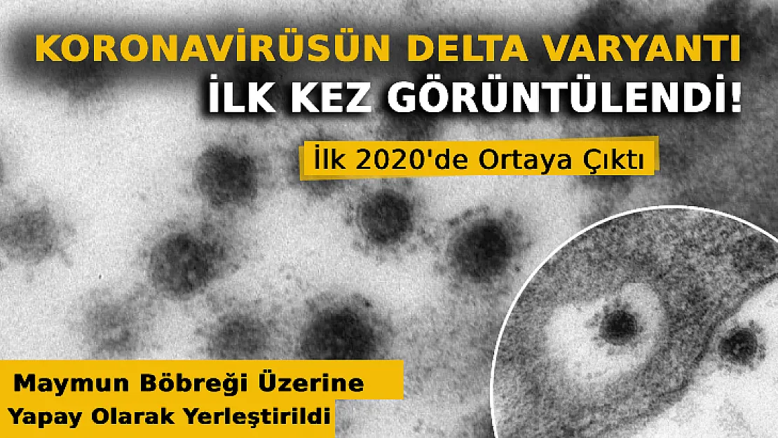 Koronavirüsün Delta Varyantı İlk Kez Görüntülendi