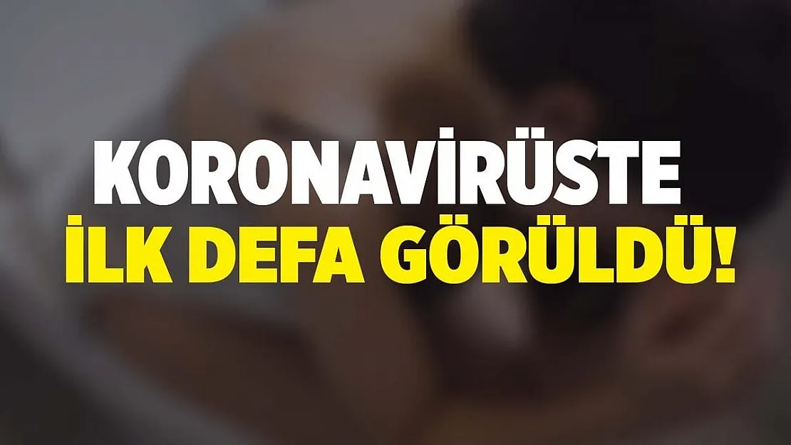 Koronavirüsün ilk defa tespit edilen yan etkisi ortaya çıktı!