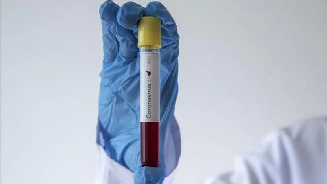 Plazma Tedavisinden Bir Güzel Haber Daha! Covid-19 Testi Negatife Döndü