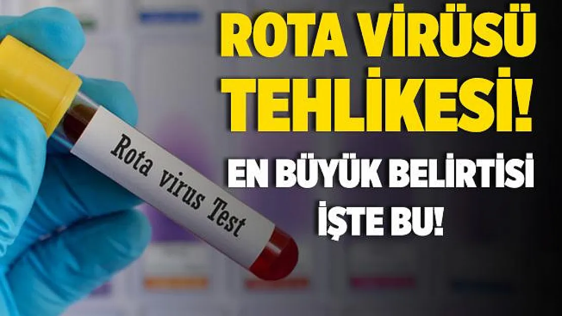 Rota virüsü tehlikesi! Bu belirtilerle kendini gösteriyor!