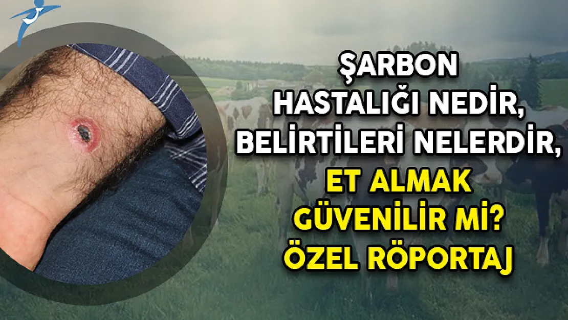 Şarbon Hastalığı Nedir, Belirtileri Nelerdir, Et Almak Güvenilir Mi? ÖZEL RÖPORTAJ