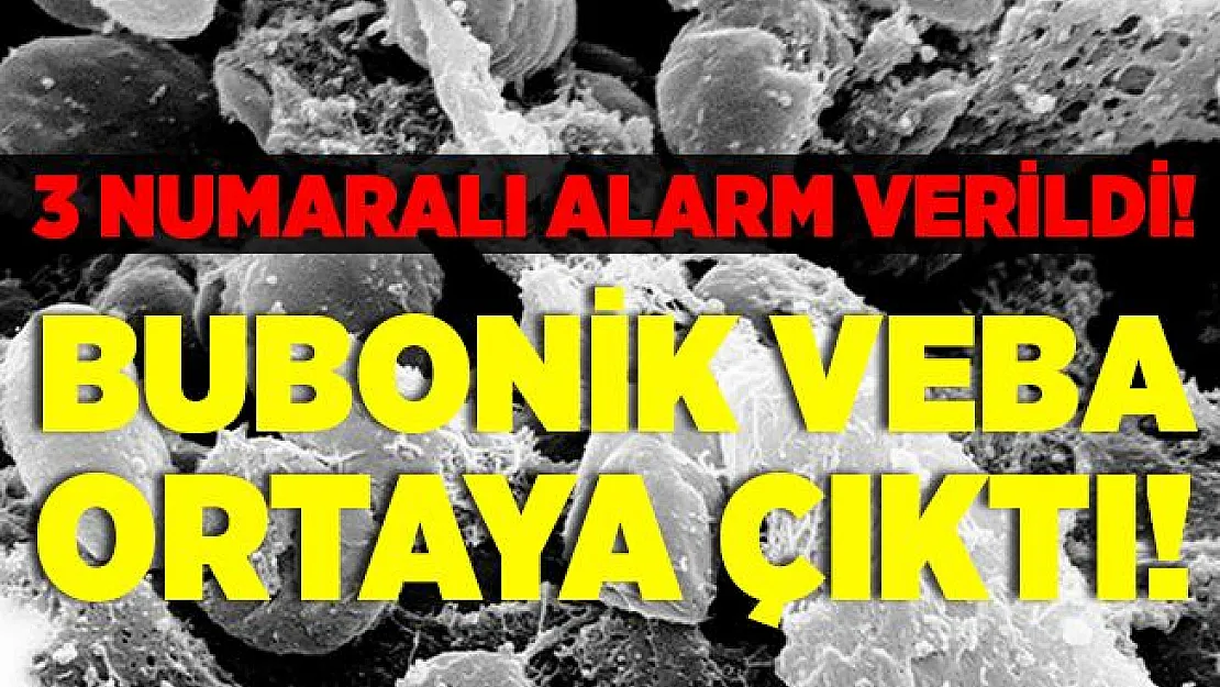 Şimdi de bubonik veba çıktı! 3 numaralı alarm verildi! Bubonik veba nedir? Çin bubonik veba belirtileri