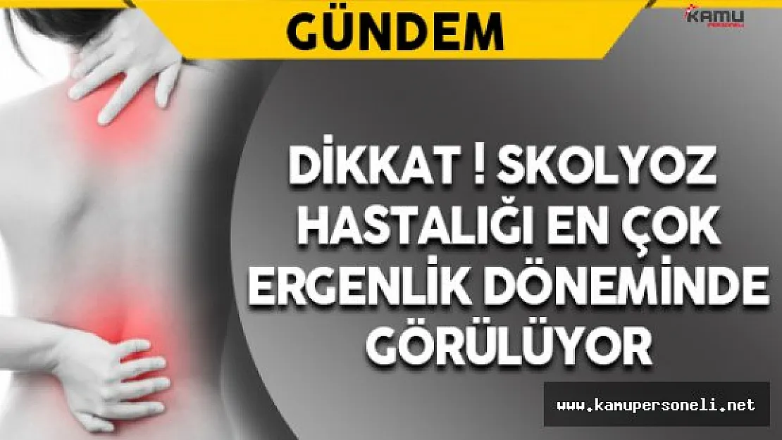 Skolyoz Hastalığı En Çok Ergenlik Çağında Görülüyor