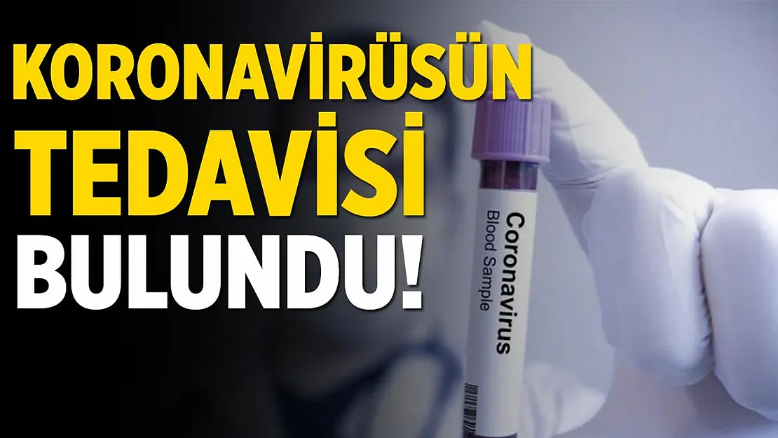 Sonunda müjdeli haber geldi! Koronavirüsün tedavisi bulundu!