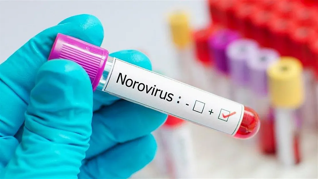 Tehlikeler art arda geliyor! Norovirüs İngiltere'de hızla yayılıyor!