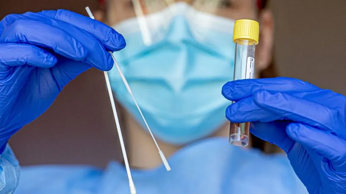 Temaslı olanlar için test uyarısı yapıldı! En erken 3 gün sonra..