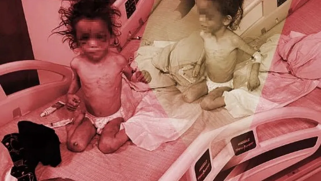 Tüm Türkiye bu anne vahşetini konuşuyor: 5 yaşındaki çocuğunu günlerce işkence ederek aç bıraktı! Durumu kritik