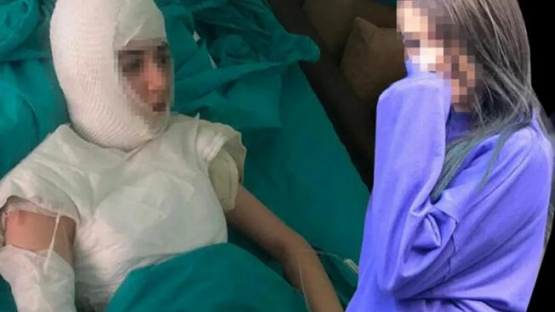 Üvey kızını kaynar suyla yakan kadın 4 ay kadar ceza yatabilir!