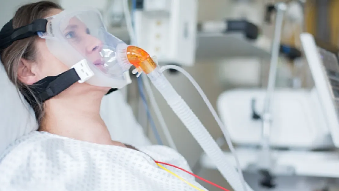 Ventilatör nedir? Yerli solunum cihazı nasıl çalışır? Ventilatörü kimler üretiyor?