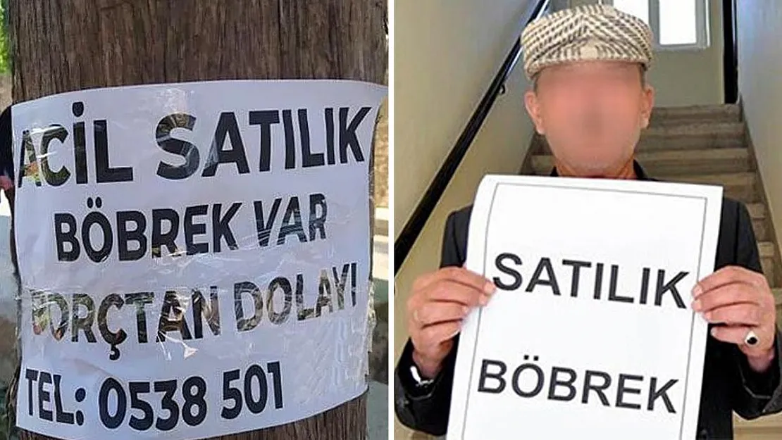 Yoksulluktan Böbrek Satışı Patladı! En Çok Bu 3 İl Satmak İstiyor