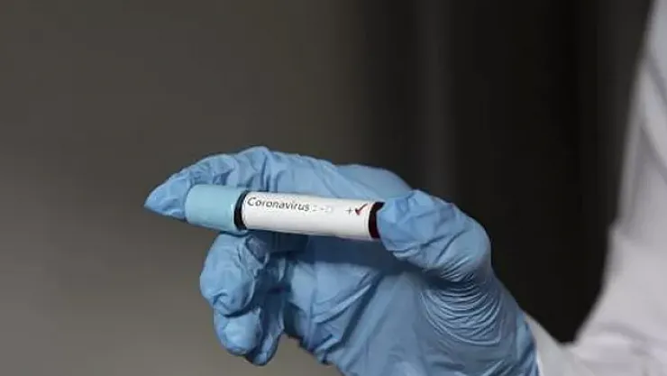 43 bin kişinin koronavirüs test sonuçları yanlış çıktı! Tüm dünyayı şoke eden olay!