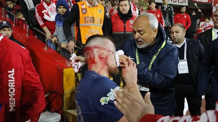 Antalyaspor'da Chico'nun burnu kırıldı