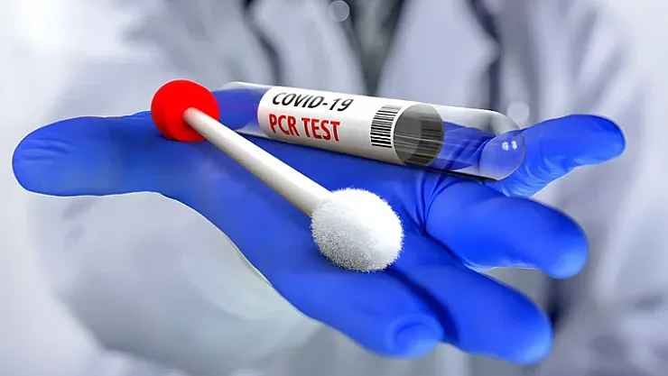 Aylarca Tüm Testleri Pozitif Çıktı! İşte En Uzun Koronavirüs Vakası!