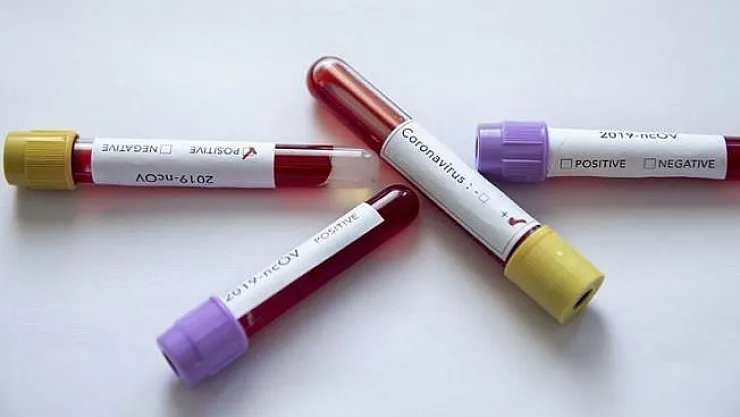 Corona Virüsü Can Almaya Devam Ediyor ! 3 Bin 139 Kişi Hayatını Kaybetti