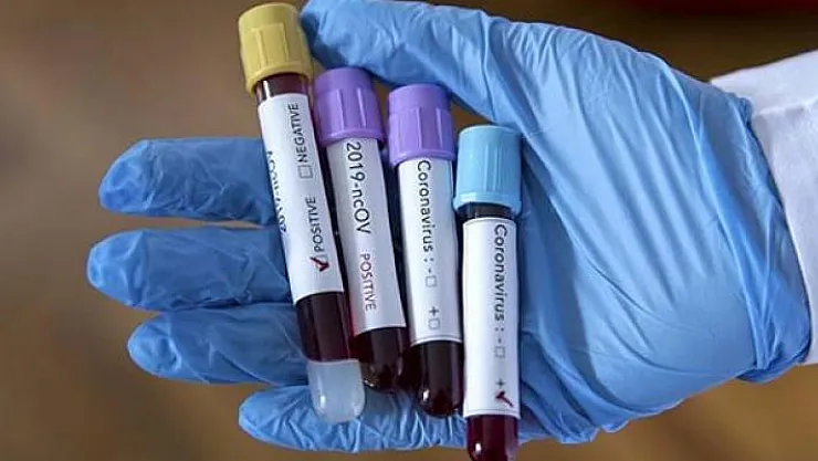 Corona virüsü komşumuz İran'a sıçradı!