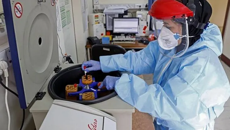 Covid-19 CoronaVirus test kiti ve Koronavirüs testi yapılabilecek hastaneler listesi: İstanbul, Ankara İzmir...