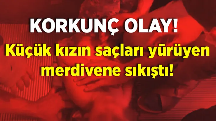Dehşet verici olay! Küçük çocuğun saçları yürüyen merdivene sıkıştı!