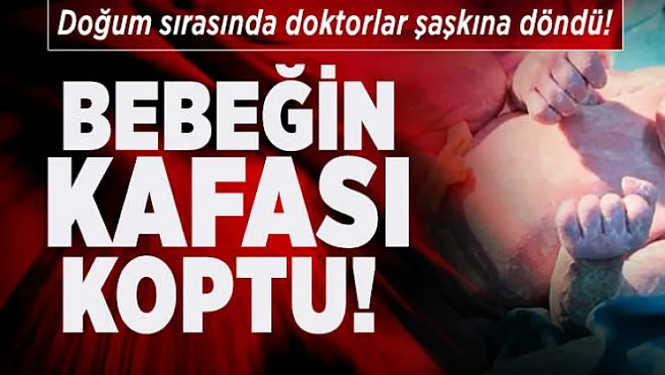 Doğum sırasında doktorlar şaşkına döndü! Bebeğin kafası koptu!