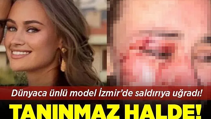 Dünyaca ünlü model Çeşme'de güvenlik görevlilerinin saldırısına uğradı! Tanınmaz hale geldi!